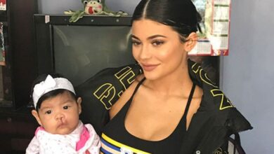 Photo of Kylie Jenner’s charity lip kit has made half a million dollars for children born with a cleft palette